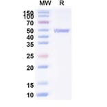SDS-PAGE - Anti-ATP7B Nanobody [2R50] (A338354) - Antibodies.com