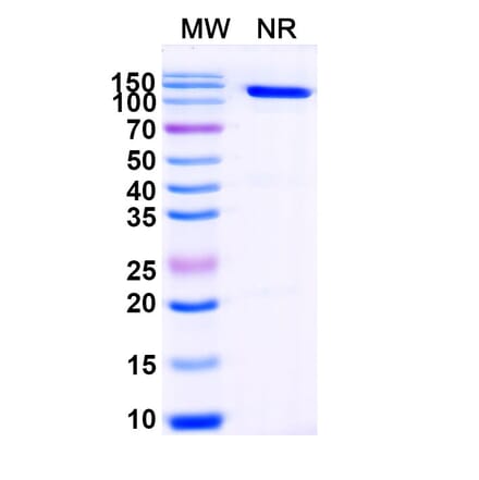 Dose-response - Anti-Glutathione S-Transferase Class-mu 26 kDa Isozyme Nanobody [ABS0324] (A338356) - Antibodies.com