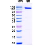 Dose-response - Anti-Glutathione S-Transferase Class-mu 26 kDa Isozyme Nanobody [ABS0324] (A338356) - Antibodies.com