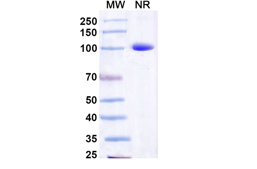 SDS-PAGE - Anti-Capsid Protein Nanobody [Nano-25] (A338359) - Antibodies.com