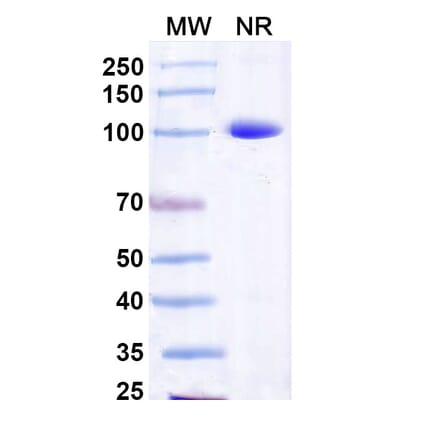 SDS-PAGE - Anti-Capsid Protein Nanobody [Nano-25] (A338359) - Antibodies.com