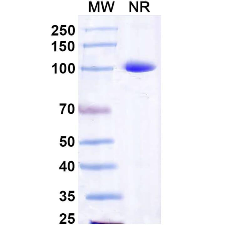 SDS-PAGE - Anti-Capsid Protein Nanobody [Nano-25] (A338359) - Antibodies.com