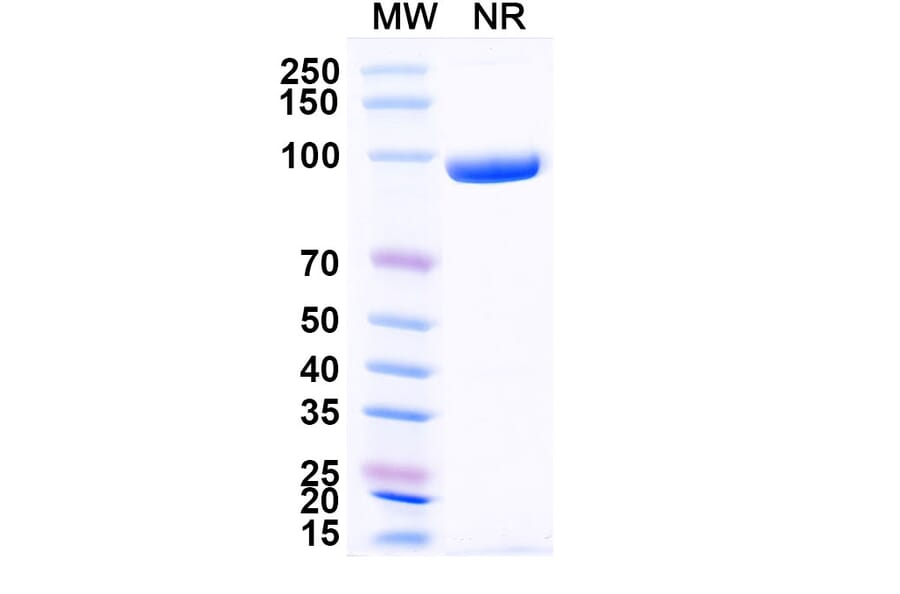 SDS-PAGE - Anti-CD3 epsilon Nanobody [SAA2242] (A338362) - Antibodies.com