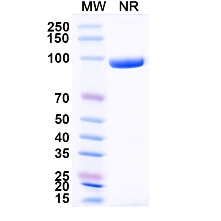 SDS-PAGE - Anti-CD3 epsilon Nanobody [SAA2242] (A338362) - Antibodies.com