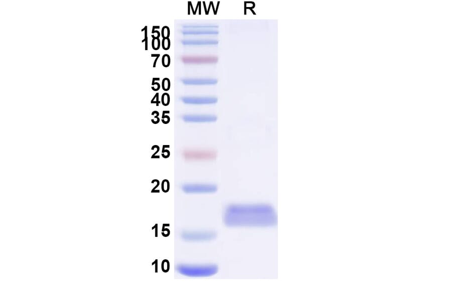 SDS-PAGE - Anti-MERS-CoV SARS-CoV-2 Spike Protein RBD Nanobody [VHH-55] (A338368) - Antibodies.com