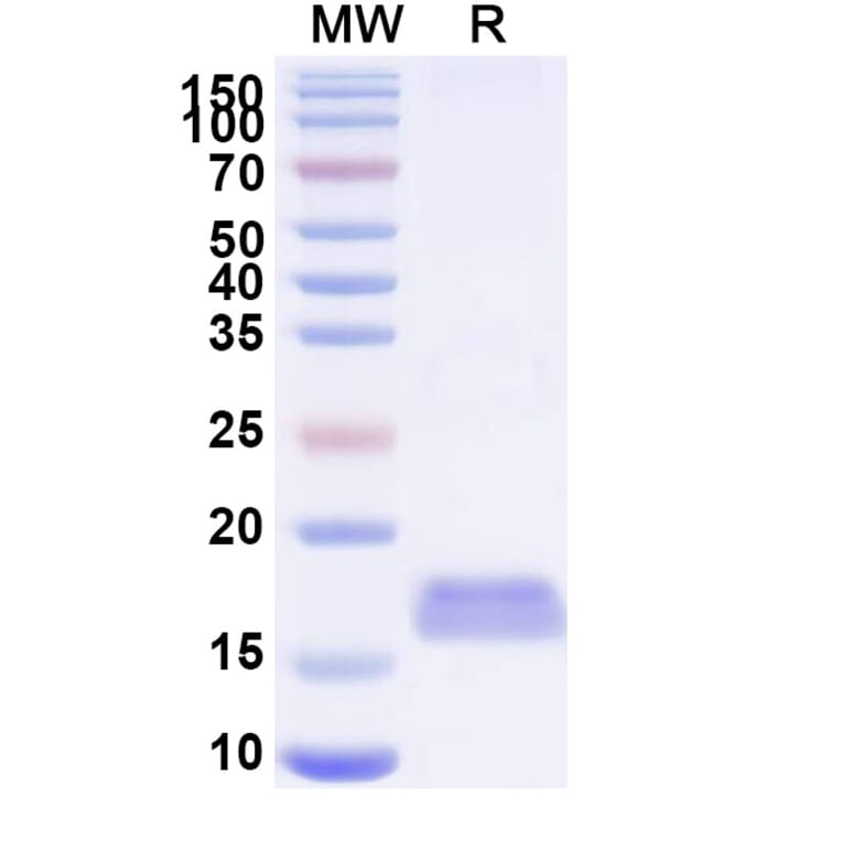 SDS-PAGE - Anti-MERS-CoV SARS-CoV-2 Spike Protein RBD Nanobody [VHH-55] (A338368) - Antibodies.com