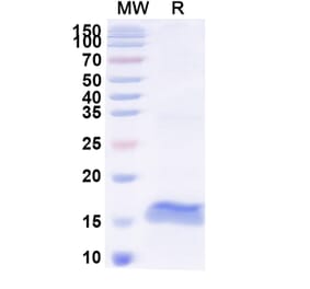 SDS-PAGE - Anti-Pancreatic alpha Amylase Nanobody [SAA2257] (A338369) - Antibodies.com