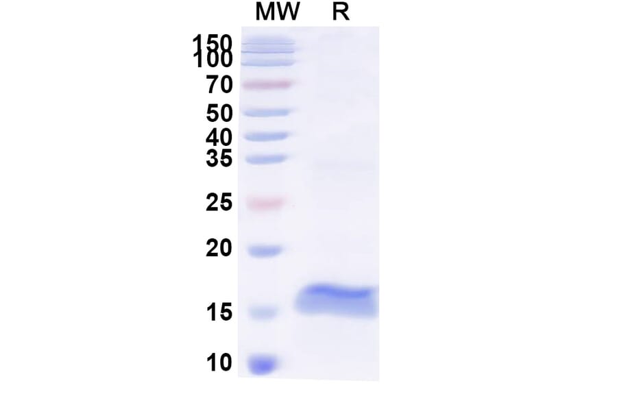 SDS-PAGE - Anti-Pancreatic alpha Amylase Nanobody [SAA2257] (A338369) - Antibodies.com