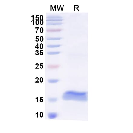 SDS-PAGE - Anti-Pancreatic alpha Amylase Nanobody [SAA2257] (A338369) - Antibodies.com