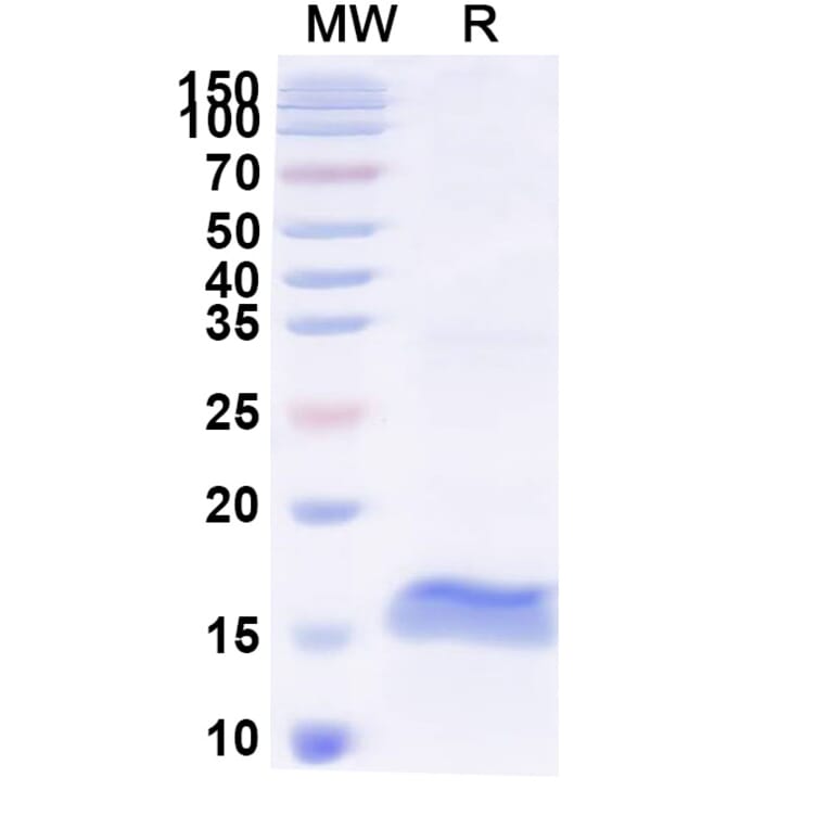 SDS-PAGE - Anti-Pancreatic alpha Amylase Nanobody [SAA2257] (A338369) - Antibodies.com