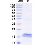 SDS-PAGE - Anti-Pancreatic alpha Amylase Nanobody [SAA2257] (A338369) - Antibodies.com