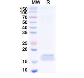 SDS-PAGE - Anti-CEP164 Nanobody [10Z] (A338371) - Antibodies.com