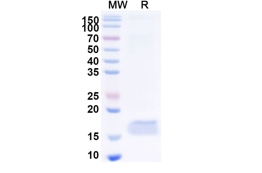 SDS-PAGE - Anti-CEP164 Nanobody [10Z] (A338371) - Antibodies.com