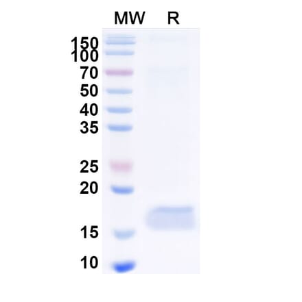 SDS-PAGE - Anti-CEP164 Nanobody [10Z] (A338371) - Antibodies.com