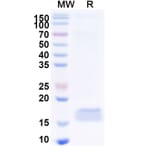SDS-PAGE - Anti-CEP164 Nanobody [10Z] (A338371) - Antibodies.com