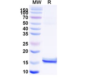 SDS-PAGE - Anti-CEP164 Nanobody [36Z] (A338372) - Antibodies.com