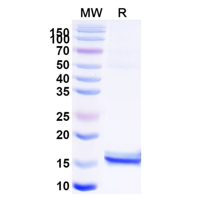 SDS-PAGE - Anti-CEP164 Nanobody [36Z] (A338372) - Antibodies.com
