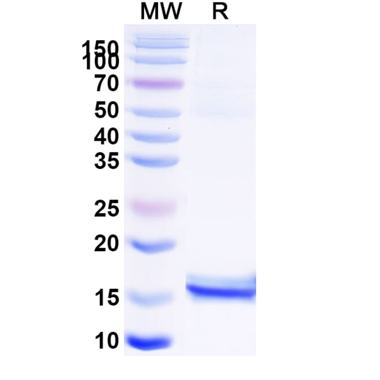 SDS-PAGE - Anti-CEP164 Nanobody [36Z] (A338372) - Antibodies.com