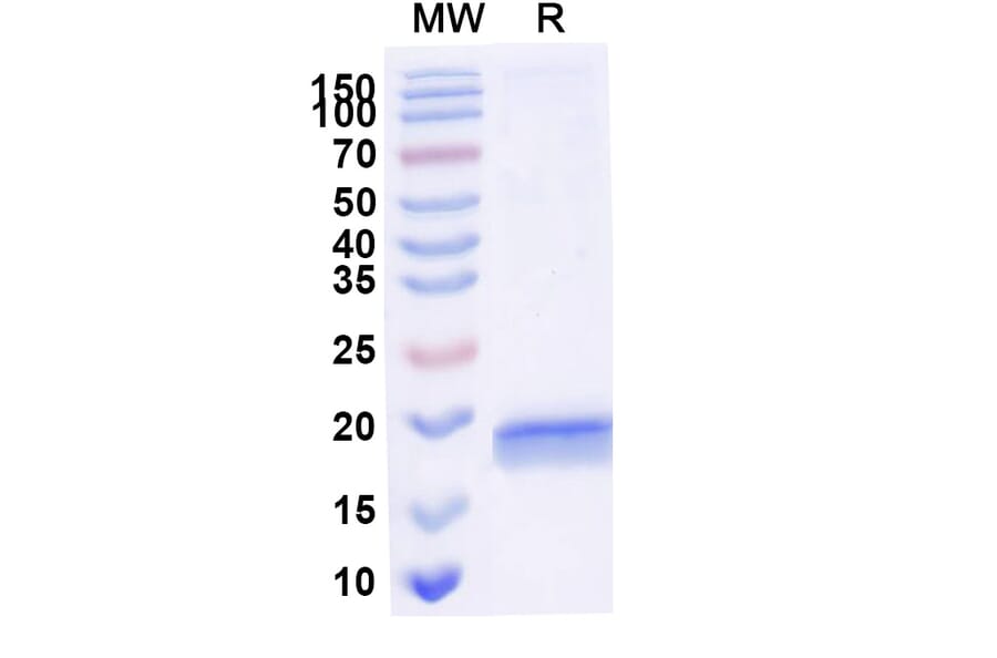 SDS-PAGE - Anti-RNase A Nanobody [SAA2261] (A338375) - Antibodies.com