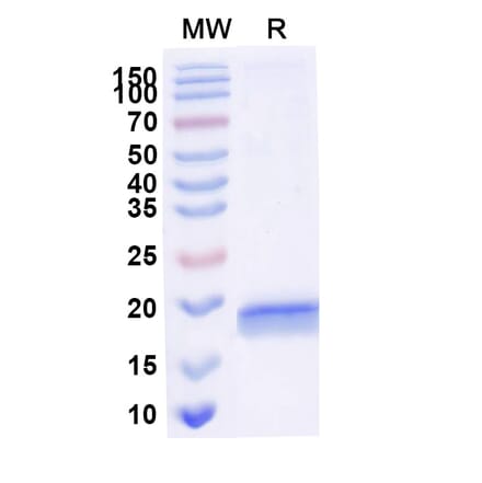 SDS-PAGE - Anti-RNase A Nanobody [SAA2261] (A338375) - Antibodies.com