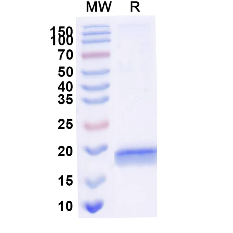 SDS-PAGE - Anti-RNase A Nanobody [SAA2261] (A338375) - Antibodies.com