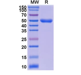 SDS-PAGE - Anti-IL-23R Nanobody (A338376) - Antibodies.com