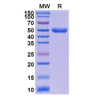 SDS-PAGE - Anti-IL-23R Nanobody (A338376) - Antibodies.com