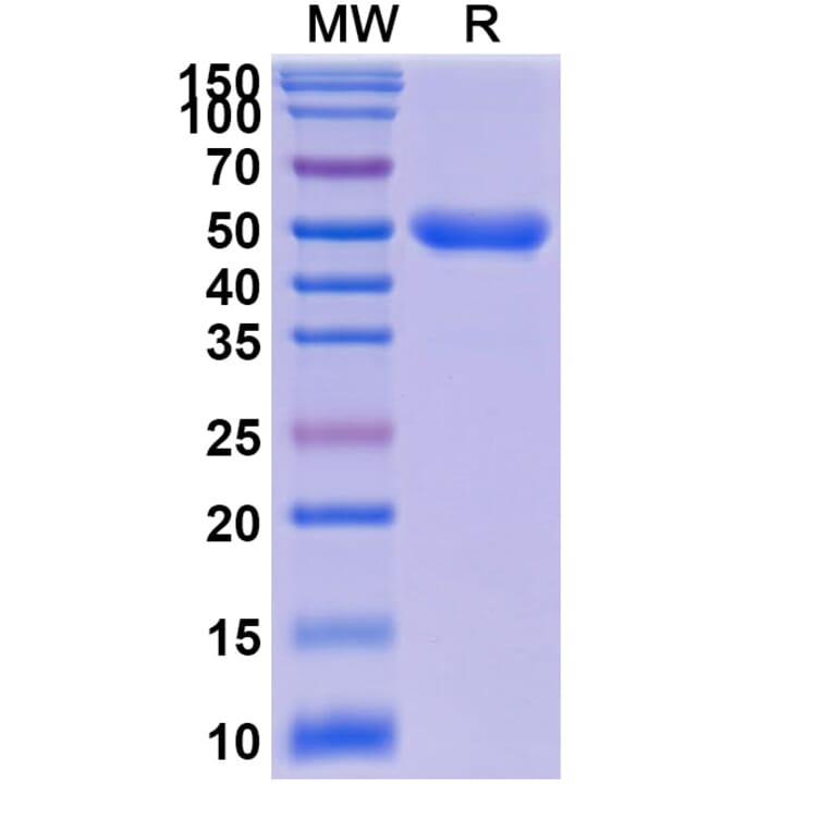 SDS-PAGE - Anti-IL-23R Nanobody (A338376) - Antibodies.com