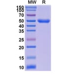 SDS-PAGE - Anti-IL-23R Nanobody (A338376) - Antibodies.com