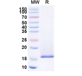 SDS-PAGE - Anti-Nucleoprotein Nanobody (A338378) - Antibodies.com