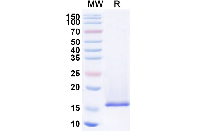 SDS-PAGE - Anti-Nucleoprotein Nanobody (A338378) - Antibodies.com