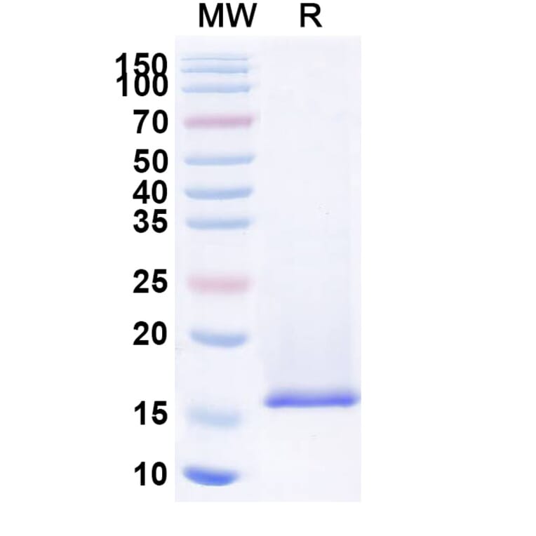 SDS-PAGE - Anti-Nucleoprotein Nanobody (A338378) - Antibodies.com