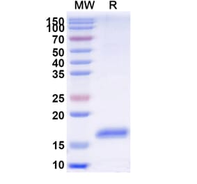 SDS-PAGE - Anti-GBA Nanobody [SAA2277] (A338386) - Antibodies.com