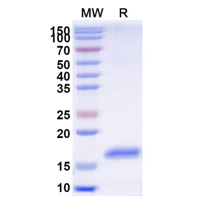 SDS-PAGE - Anti-GBA Nanobody [SAA2277] (A338386) - Antibodies.com