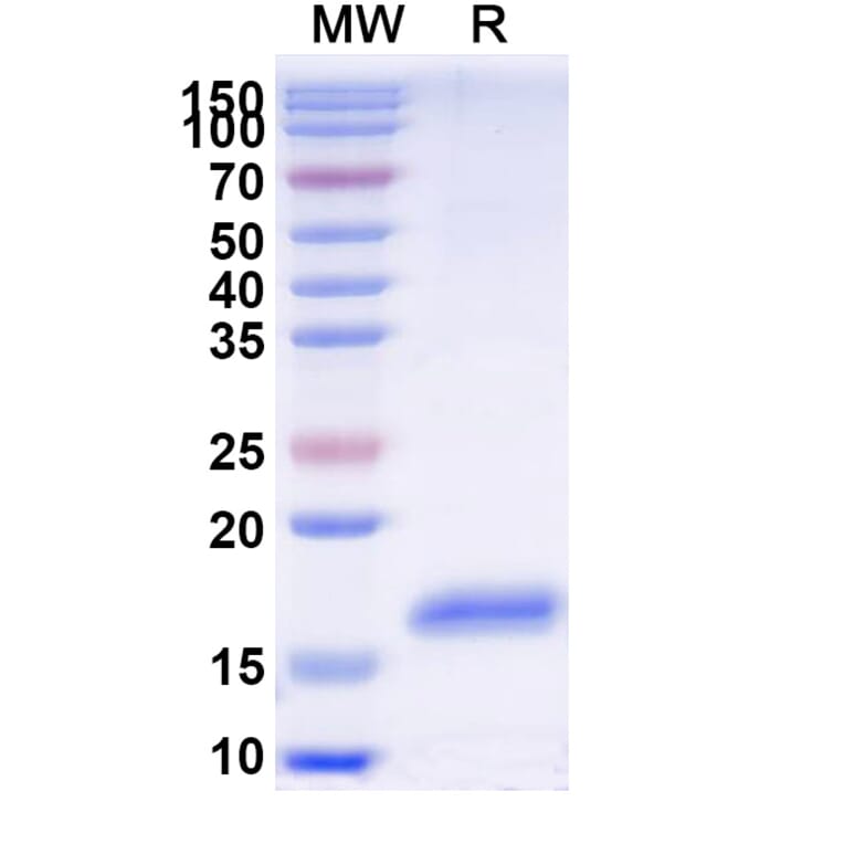 SDS-PAGE - Anti-GBA Nanobody [SAA2277] (A338386) - Antibodies.com