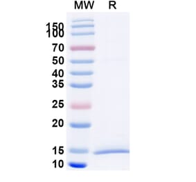 SDS-PAGE - Anti-KIR2DL1 Nanobody [SAA2281] (A338388) - Antibodies.com