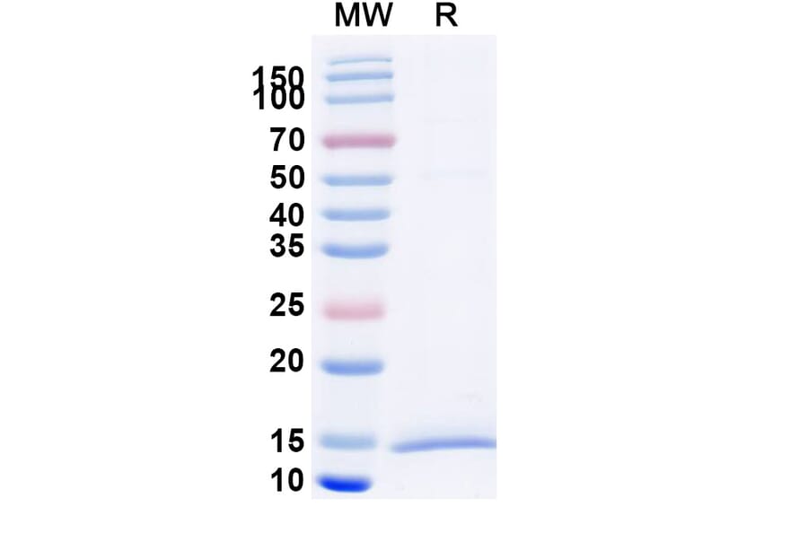 SDS-PAGE - Anti-KIR2DL1 Nanobody [SAA2281] (A338388) - Antibodies.com
