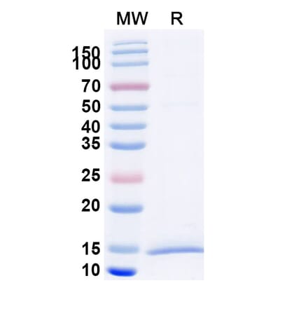 SDS-PAGE - Anti-KIR2DL1 Nanobody [SAA2281] (A338388) - Antibodies.com