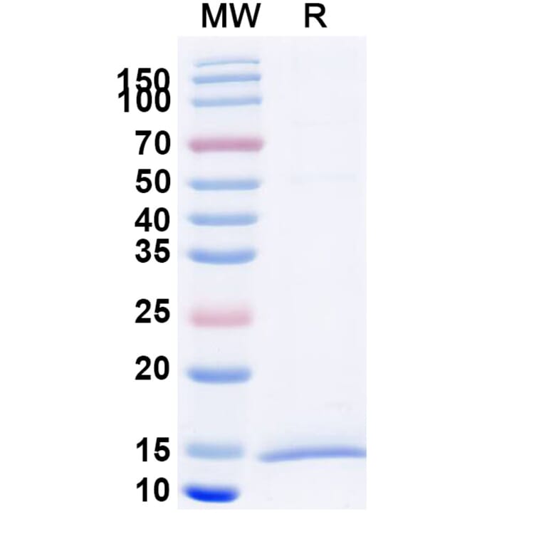SDS-PAGE - Anti-KIR2DL1 Nanobody [SAA2281] (A338388) - Antibodies.com