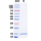 SDS-PAGE - Anti-KIR2DL1 Nanobody [SAA2281] (A338388) - Antibodies.com