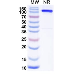 SDS-PAGE - Anti-Mu Opioid Receptor Nanobody [SAA2285] (A338389) - Antibodies.com