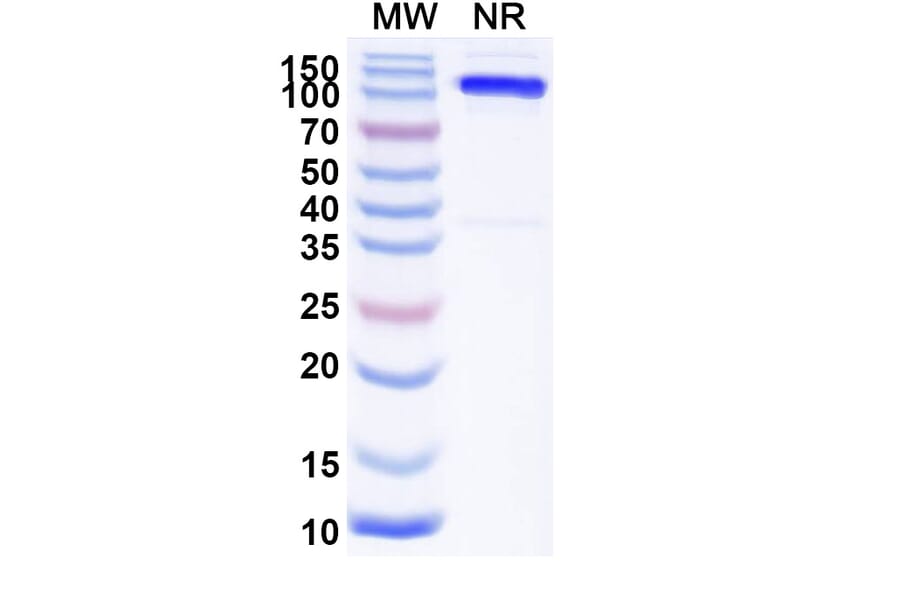 SDS-PAGE - Anti-Mu Opioid Receptor Nanobody [SAA2285] (A338389) - Antibodies.com