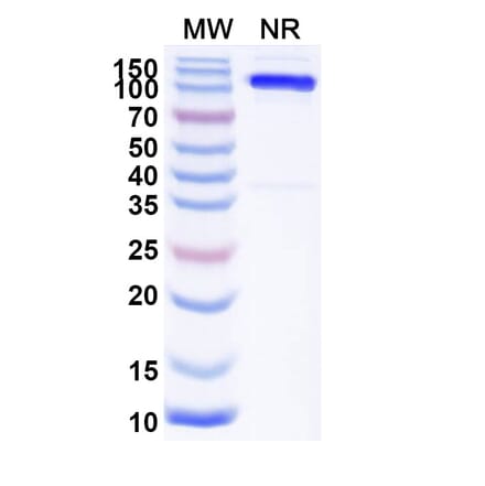 SDS-PAGE - Anti-Mu Opioid Receptor Nanobody [SAA2285] (A338389) - Antibodies.com