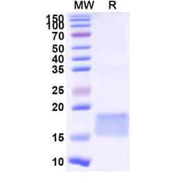 SDS-PAGE - Anti-LILRB3 Nanobody [SAA2289] (A338391) - Antibodies.com