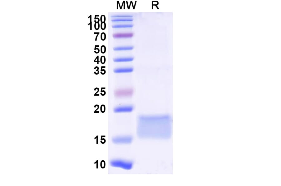 SDS-PAGE - Anti-LILRB3 Nanobody [SAA2289] (A338391) - Antibodies.com