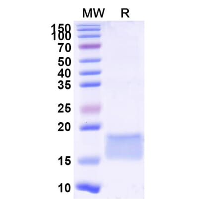 SDS-PAGE - Anti-LILRB3 Nanobody [SAA2289] (A338391) - Antibodies.com