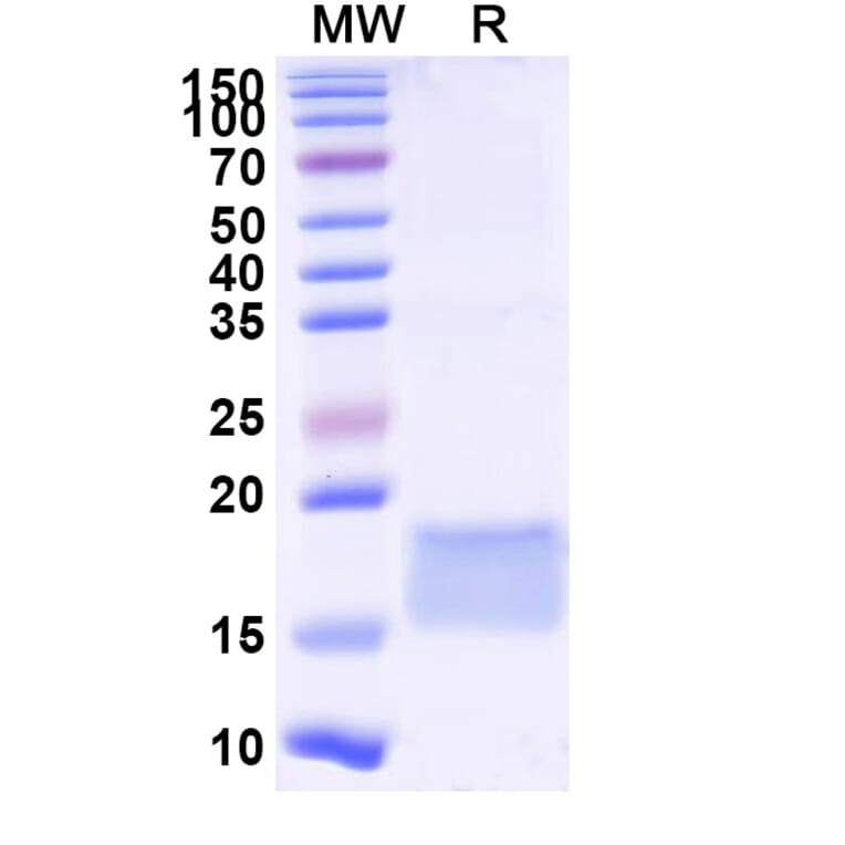 SDS-PAGE - Anti-LILRB3 Nanobody [SAA2289] (A338391) - Antibodies.com