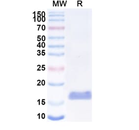 SDS-PAGE - Anti-LGR4 Nanobody [SAA2294] (A338392) - Antibodies.com