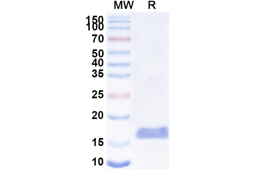SDS-PAGE - Anti-LGR4 Nanobody [SAA2294] (A338392) - Antibodies.com