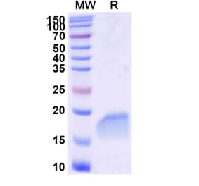 SDS-PAGE - Anti-PTRF Nanobody [SAA2295] (A338393) - Antibodies.com